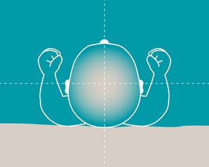 Kopfverformungen bei Baby vermeiden