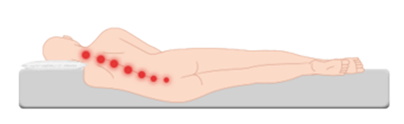 zu weiche Matratze, Fehlstellung Wirbelsäule